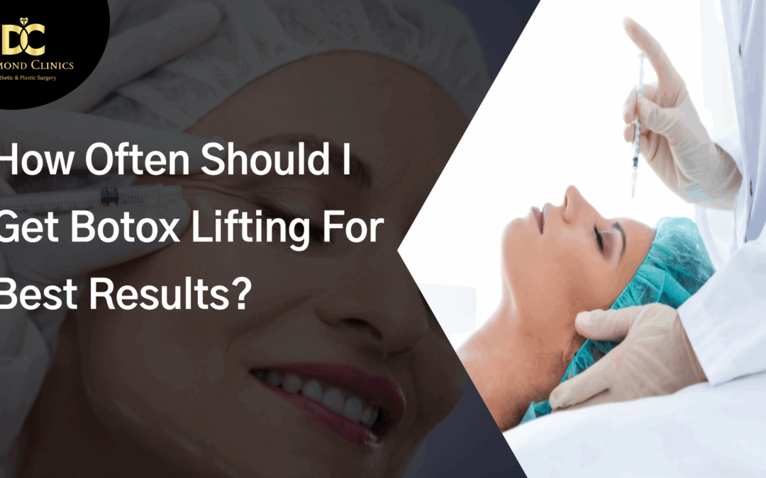 How Often Should I Get Botox Lifting for Best Results?
